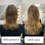 losjonas nuo plauku slinkimo