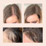 losjonas-plauku-slinkimas-rezultatas